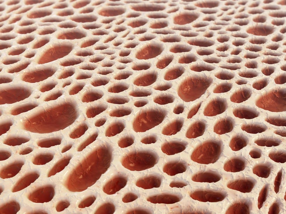 Scientists Discover Why You Really Have Trypophobia