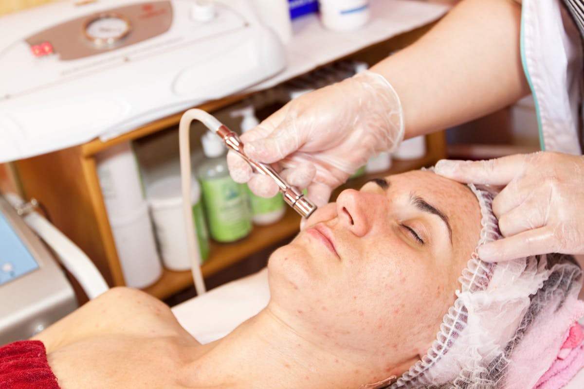 Microdermabrasion-facial-treatment-at-spa