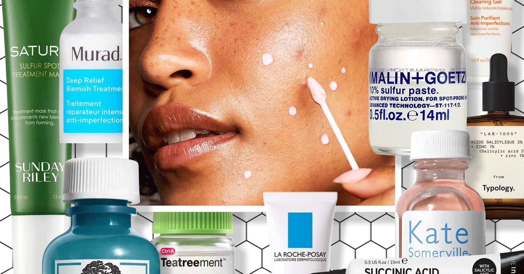 11 best spot treatments for acne, blemishes, pimples 2022